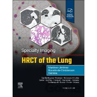 Specialty Imaging: HRCT of the Lung - FAAWR Rosado-de-Christenson
