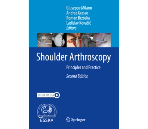 Shoulder Arthroscopy