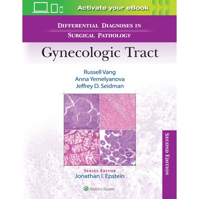 Differential Diagnoses in Surgical Pathology: Gynecologic Tract