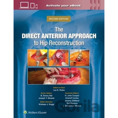 The Direct Anterior Approach to Hip Reconstruction