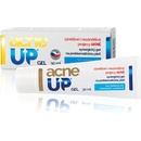 AcneUP Gel na akné a problematickou pleť 30 ml