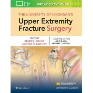 University of Michigan's Upper Extremity Fracture Surgery | Chung (ISBN: 9781975110437)