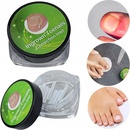 Deni Carte Spona na zarastajúce nechty