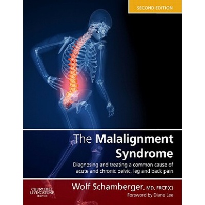 Malalignment Syndrome: Common Pelvic and Back Pain