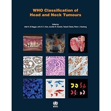 WHO Classification of Head and Neck Tumours - Adel K. El-Naggar a kol.