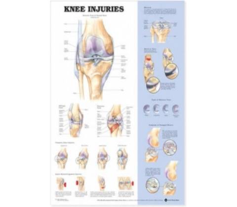 Knee Injuries Anatomical Chart