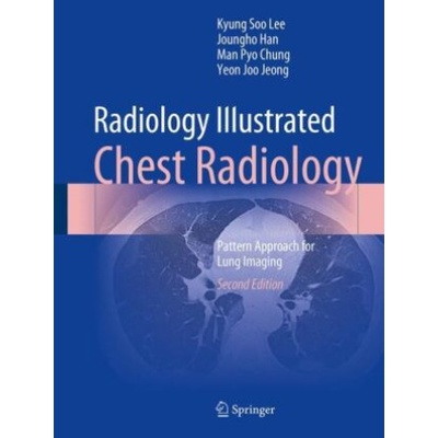 Radiology Illustrated: Chest Radiology | Kyung Soo Lee, Joungho Han, Man Pyo Chung, Yeon Joo Jeong