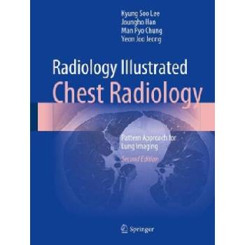 Radiology Illustrated: Chest Radiology | Kyung Soo Lee, Joungho Han, Man Pyo Chung, Yeon Joo Jeong