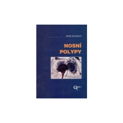 Nosní polypy - Zdeňka Kuchynková