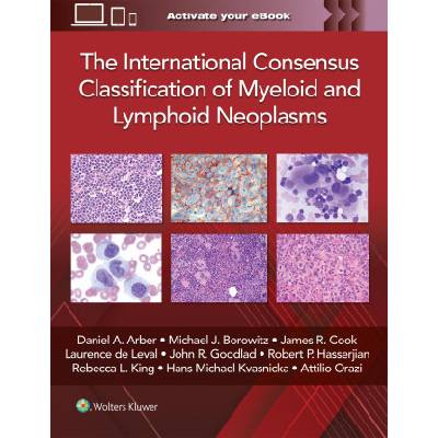 The International Consensus Classification of Myeloid and Lymphoid Neoplasms | ARBER, DANIEL A