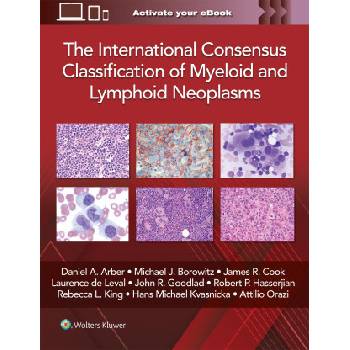The International Consensus Classification of Myeloid and Lymphoid Neoplasms | ARBER, DANIEL A