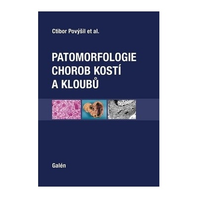 Patomorfologie chorob kostí a kloubů - Ctibor Povýšil