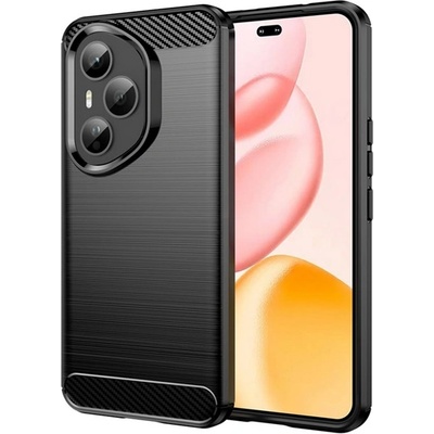 Gigapack Honor 400 Pro GIGAPACK Силиконов протектор за телефон, удароустойчив, карбонов модел, ЧЕРЕН GP-170355 (GP-170355)
