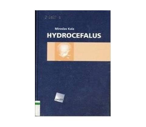 Hydrocefalus