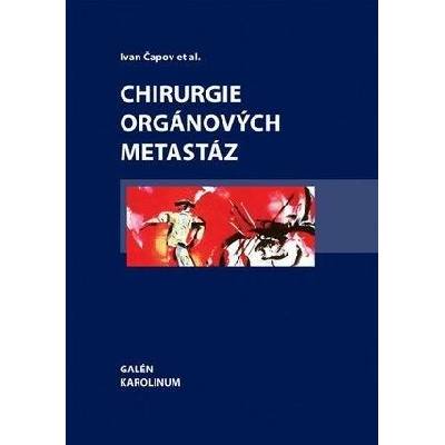Chirurgie orgánových metastáz - Ivan Čapov
