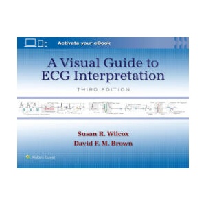 Visual Guide to ECG Interpretation | Wilcox & Brown (2024)