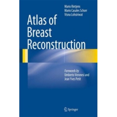Atlas of Breast Reconstruction Rietjens Mario