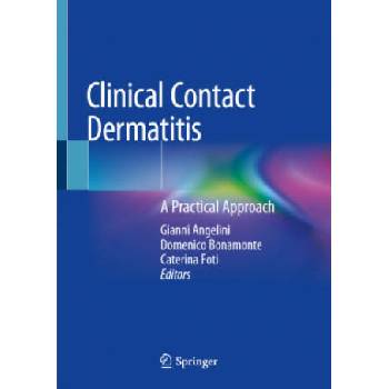 Image 1 of Clinical Contact Dermatitis: A Practical Approach | Gianni Angelini, Domenico Bonamonte, Caterina Foti