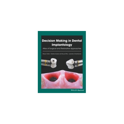 Decision Making in Dental Implantology - Atlas of Surgical and Restorative Approaches Pevná vazba