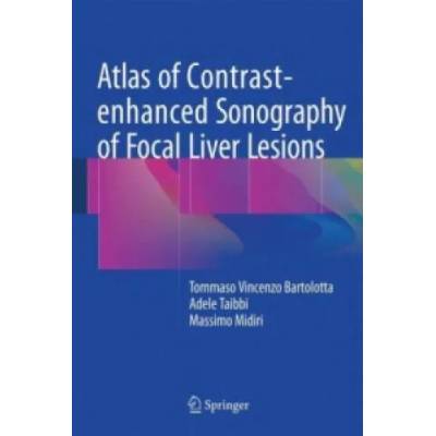 Atlas of Contrast-enhanced Sonography of Focal Liver Lesions | Tommaso Vincenzo Bartolotta, Adele Taibbi, Massimo Midiri