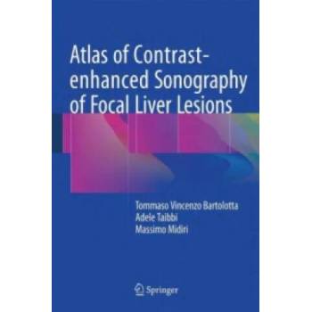 Image 1 of Atlas of Contrast-enhanced Sonography of Focal Liver Lesions | Tommaso Vincenzo Bartolotta, Adele Taibbi, Massimo Midiri