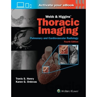 Webb & Higgins Thoracic Imaging Print + eBook with Multimedia - KAREN GOMES MD MAS ORDOVAS Travis Henry
