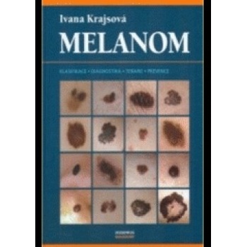 Melanom