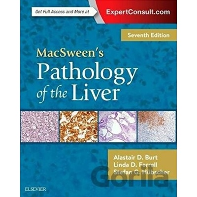 MacSweens Pathology of the Liver - Alastair D. Burt, Linda D. Ferrell, Stefan G. Hubscher