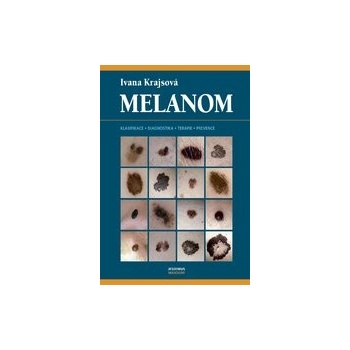 Melanom