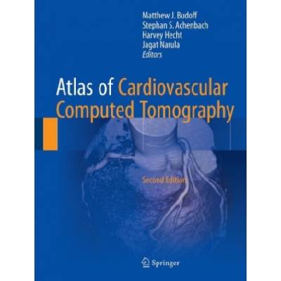 Atlas of Cardiovascular Computed Tomography | Matthew J. Budoff, Stephan S. Achenbach, Harvey S. Hecht, Jagat Narula