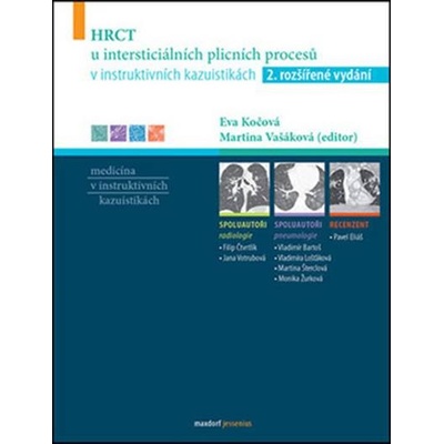 HRCT u intersticiálních plicních procesů v instruktivních kazuistikách Eva Kočo