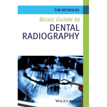 Basic Guide to Dental Radiography Reynolds Tim