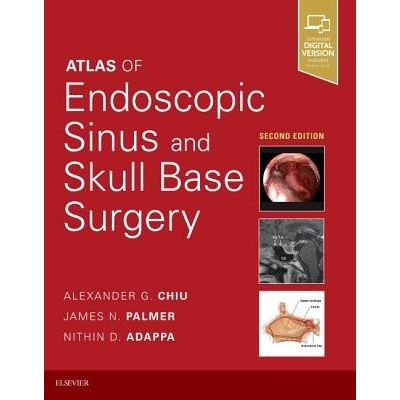 Atlas of Endoscopic Sinus and Skull Base Surgery Chiu Alexander G.Pevná vazba