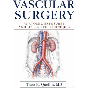 Vascular Surgery