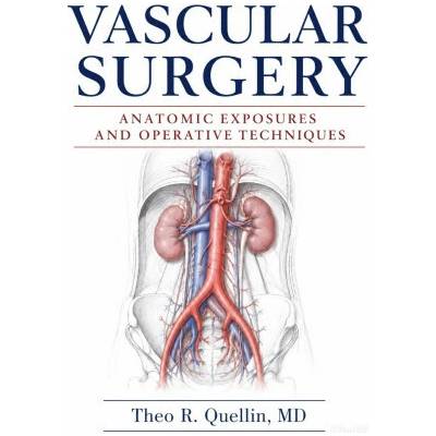 Vascular Surgery
