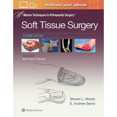 Master Techniques in Orthopaedic Surgery: Soft Tissue Surgery