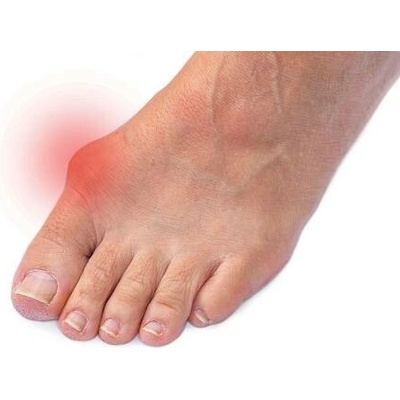 VV Design Komfort Hallux Valgus