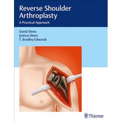 Reverse Shoulder Arthroplasty: A Practical Approach Dines David M.Pevná vazba