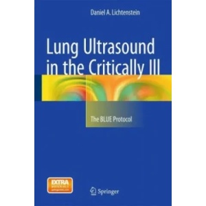 Lung Ultrasound in the Critically Ill | Daniel A. Lichtenstein (ISBN: 9783319153704)