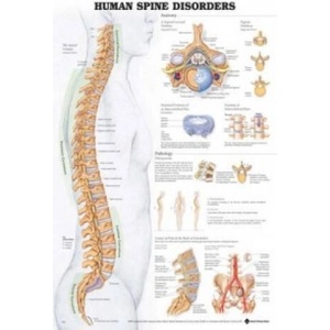 Human Spine Disorders Anatomical Chart | Anatomical Chart Company (ISBN: 9781587794438)
