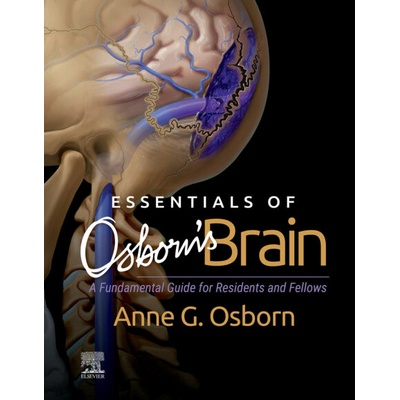 Essentials of Osborn's Brain