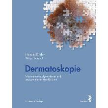 Dermatoskopie