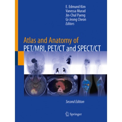 Atlas and Anatomy of PET/MRI, PET/CT and SPECT/CT | E. Edmund Kim, Vanessa Murad, Jin-Chul Paeng, Gi-Jeong Cheon