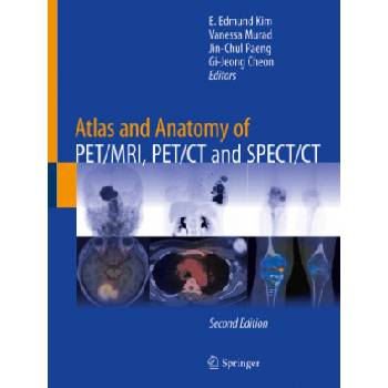 Atlas and Anatomy of PET/MRI, PET/CT and SPECT/CT | E. Edmund Kim, Vanessa Murad, Jin-Chul Paeng, Gi-Jeong Cheon