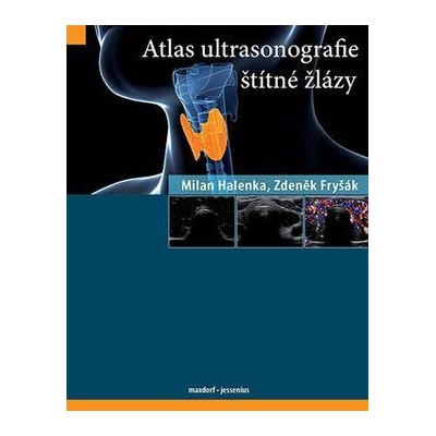 Atlas ultrasonografie štítné žlázy - Milan Halenka; Zdeněk Fryšák