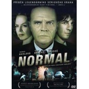 Normal DVD