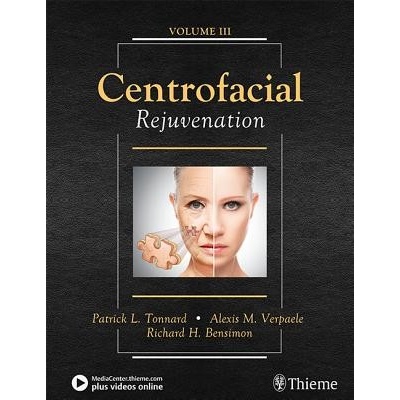 Centrofacial Rejuvenation Tonnard PatrickPevná vazba