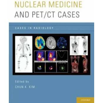 Image 1 of Nuclear Medicine and PET/CT Cases | Chun K. Kim
