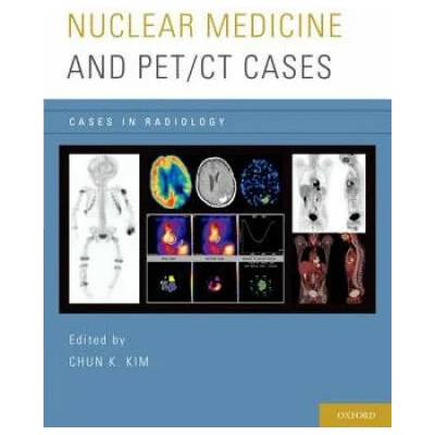 Nuclear Medicine and PET/CT Cases | Chun K. Kim