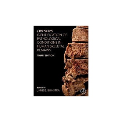 Ortner´s Identification of Pathological Conditions in Human Skeletal Remains